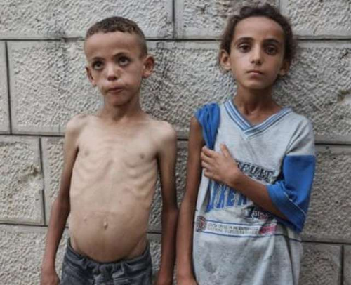 Till when will Palestinian children suffer   I  Dan Ojowa  OjowaForPresident2027 Kenya  believe in Palestine Republic  It s time  