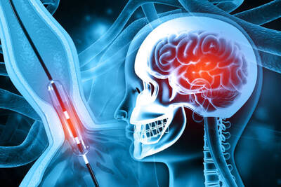 Best Neurosurgeon in Zirakpur | Expert Neurological Care | Excel Medi Clinics
