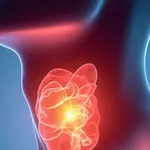 What Are the Warning Signs of Thyroid Cancer?