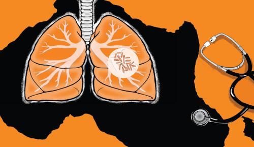 Kenya Joins World In Marking World TB Day