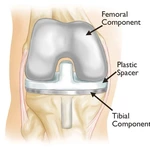 How to Choose the Right Orthopedic Hospital in Mumbai for Bone and Joint Care