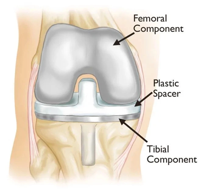 How to Choose the Right Orthopedic Hospital in Mumbai for Bone and Joint Care