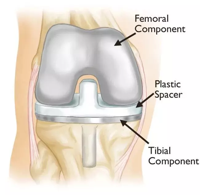How to Choose the Right Orthopedic Hospital in Mumbai for Bone and Joint Care
