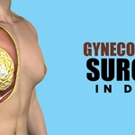 Why Proper Diagnosis Matters Before Treating Gynecomastia?
