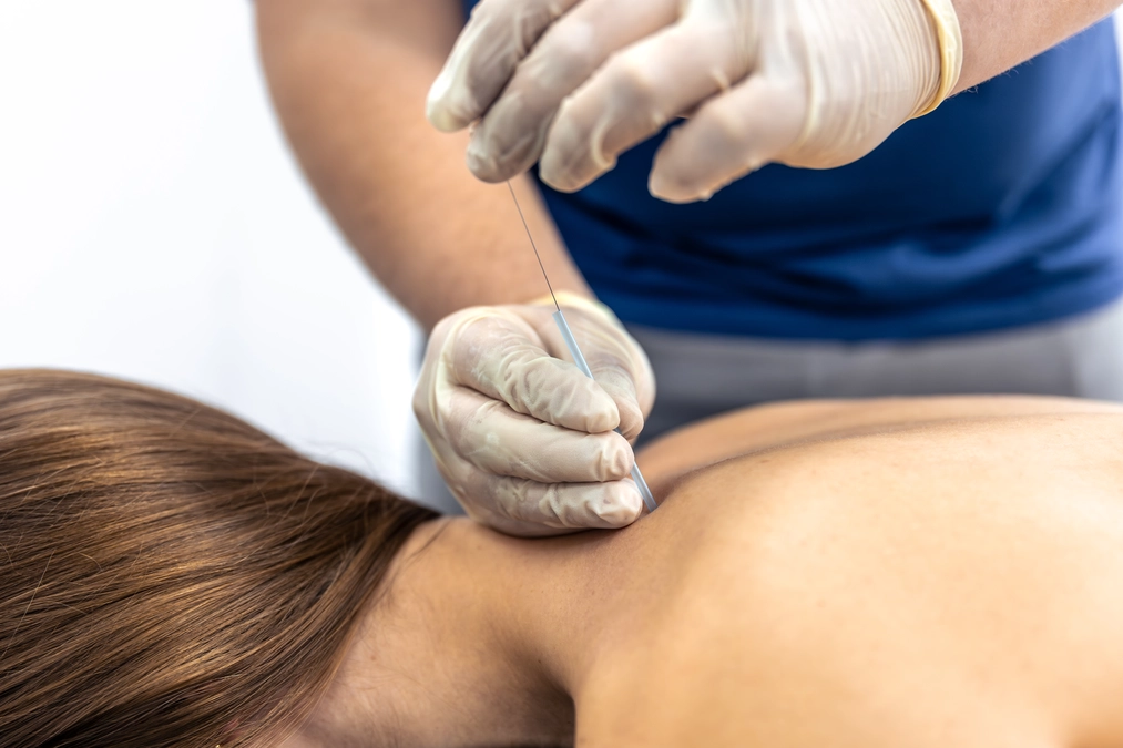 How Acupuncture May Help Support Fertility and Reproductive Health