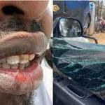 Journalists Harassed And Robbed While Covering Demos