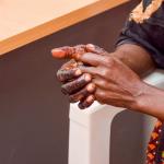 Kilifi Woman With Rare Allergic Reactions Due To Cashew Nut Crushing Begins Treatment