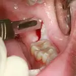 Dental Surgeon: Complete Guide to Treatments & Care