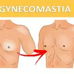 When men search for gynecomastia surgery cost in India, one of the first things they notice is how wide the price range is. One clinic quotes Rs. 30,000. Another quotes Rs. 2,00,000. Both call it gynecomastia surgery. So what is actually different, and wh