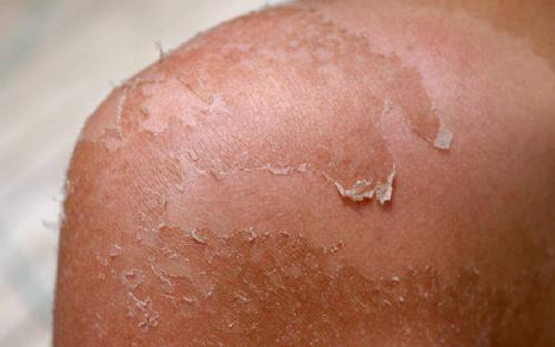 Affected By Recent High Temperatures In Kenya? What You Should Know