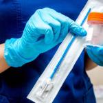 Self-Collection Sample Test Replacing Pap Smear For Cervical Cancer Screening