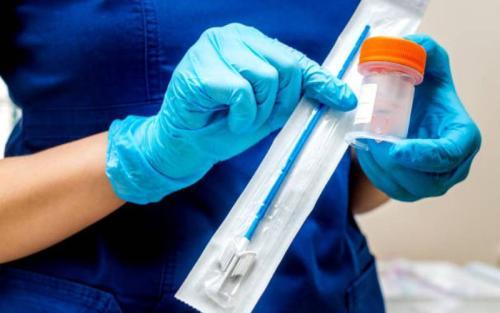 Self-Collection Sample Test Replacing Pap Smear For Cervical Cancer Screening