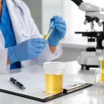 Urine Test in Orlando: A Convenient Tool for Health Assessment