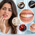 Why Are Teeth Yellow Even After Brushing? Causes & Tips
