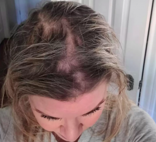 Olaplex Products Cause Hair Loss, Lawsuit Claims
