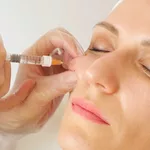 How Cheek Fillers in Nottingham Can Transform Your Facial Profile