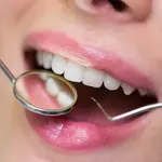 Gum Contouring: How It Creates a More Balanced and Confident Smile