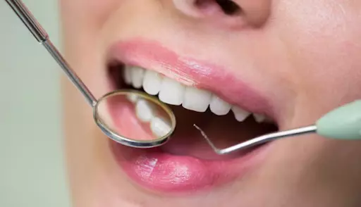 Gum Contouring: How It Creates a More Balanced and Confident Smile