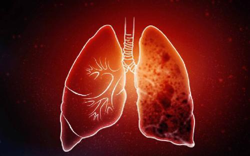 Kemri: TB Vaccine Trials Promising