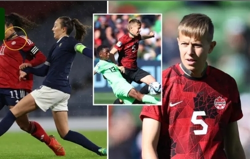 Why Players At Women's World Cup Are Wearing "Collars" Around Their Necks