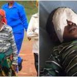 Baby Sagini Accuses Grandmother Of Gouging Out His Eyes