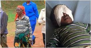 Baby Sagini Accuses Grandmother Of Gouging Out His Eyes