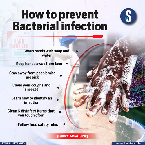 How To Prevent Bacterial Infection