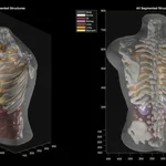 From Cat Images to Full-Body Scans: The Rise of Midjourney Medical in Healthcare AI