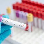Educate Young People More About HIVAids