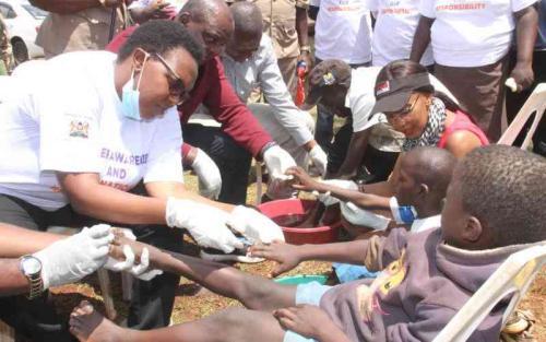 Don't Kick Out Learners With Jiggers, Schools Told