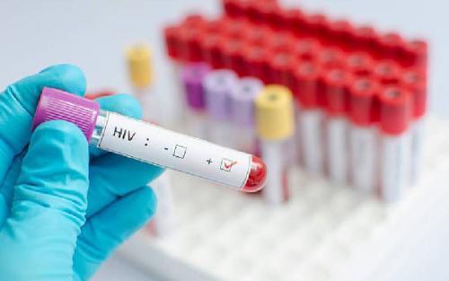 Educate Young People More About HIVAids