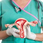 HPV Self-Testing a Game-Changer For Cervical Cancer Screening