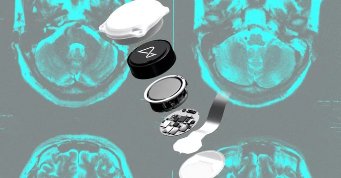 Neuralink Bet Questioned as BCI Focus Shifts