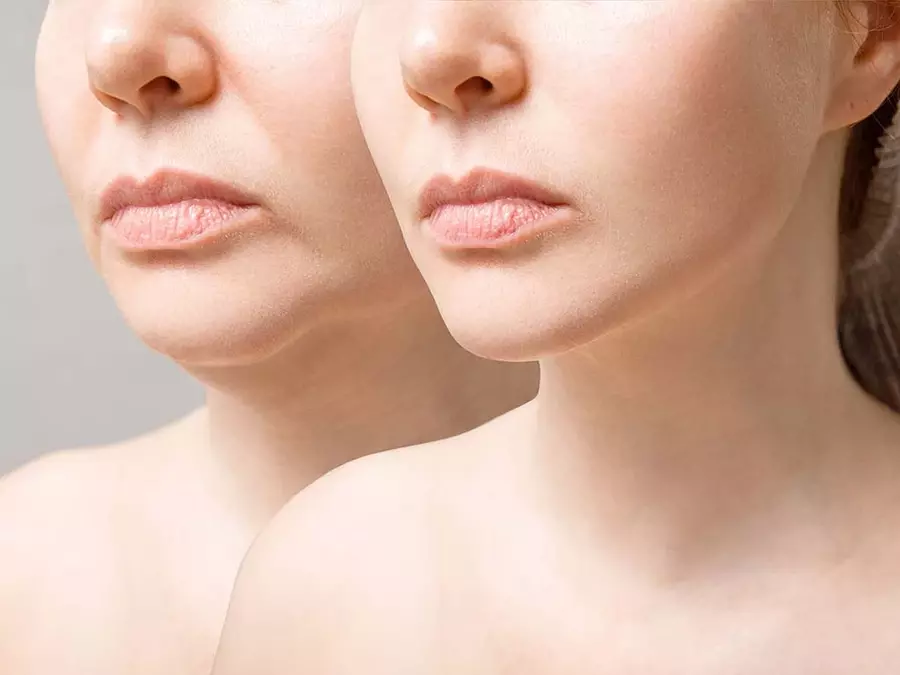Rethinking Topical Skincare Myths and Embracing Deep Dermal Remodeling