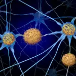 Scientists find a way to fight Alzheimer’s brain damage without removing toxic tau