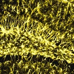 Memory stays strong in old age when this brain enzyme is active