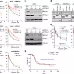 Author Correction: DYNLL1 binds to MRE11 to limit DNA end resection in BRCA1-deficient cells