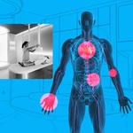 I got a $499 body scan to see if I have cancer. Here’s what I learned.