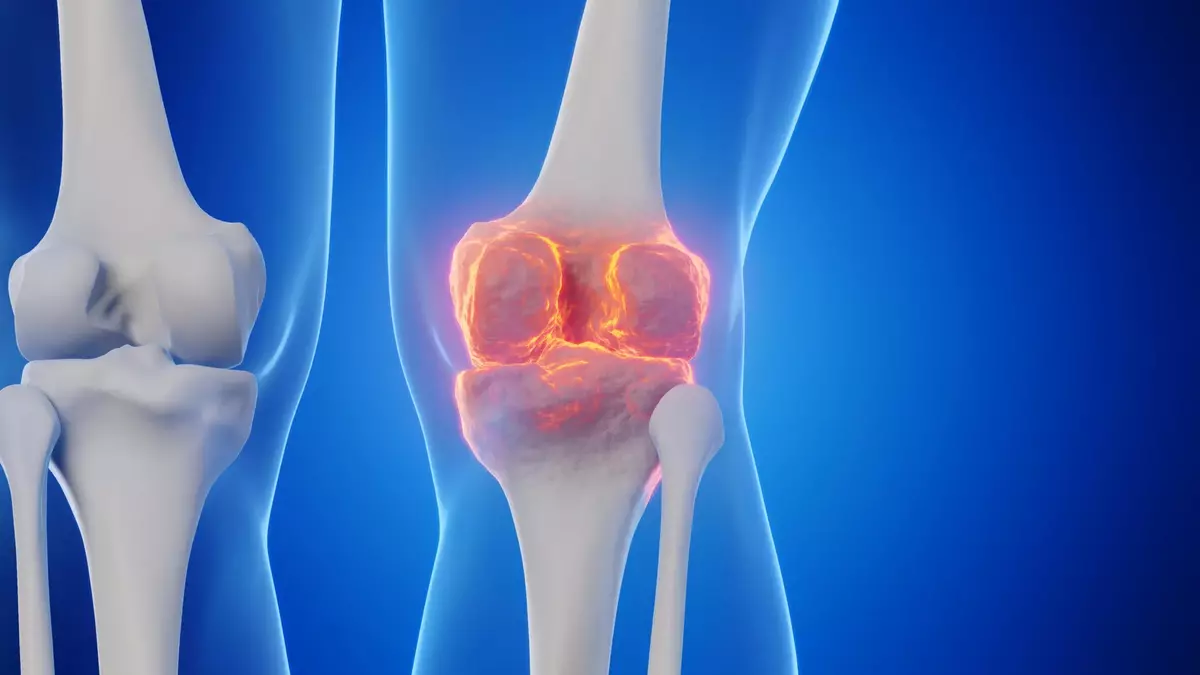 Goodbye joint replacements? Stanford scientists found a way to regrow cartilage and stop arthritis