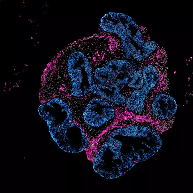 Intero Biosystems wants drugmakers to test on mini human intestines, not animals