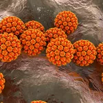 1 in 8 cancer cases are caused by infections