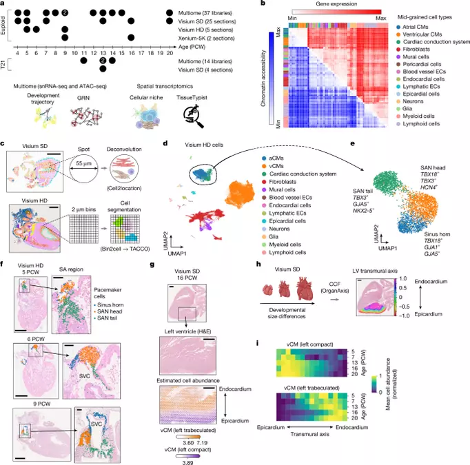 Dynamics of human cardiogenesis and its disruption in trisomy 21
