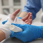 Vanillin provides a sweet solution for chronic wound healing