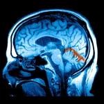 Can GLP-1s heal the brain? Obesity drugs get a makeover for addiction and depression