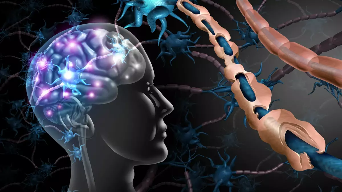 Brain cells meant to protect us may be fueling cognitive decline