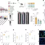 A gut microbial odd-chain fatty acid alleviates atherosclerosis in mice