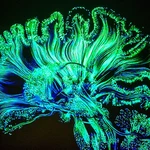 Microdosing LSD shows some cognitive benefits — but only for women
