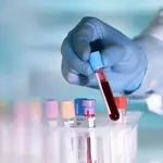 Your blood could reveal inflammatory bowel disease 10 years before diagnosis
