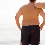 WHO says no obesity drugs, surgery for under-10s