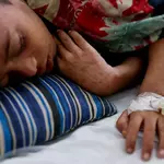 Bangladesh is battling measles. It's a 'real warning' to other nations